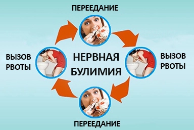 Лечение булимии в Шуе